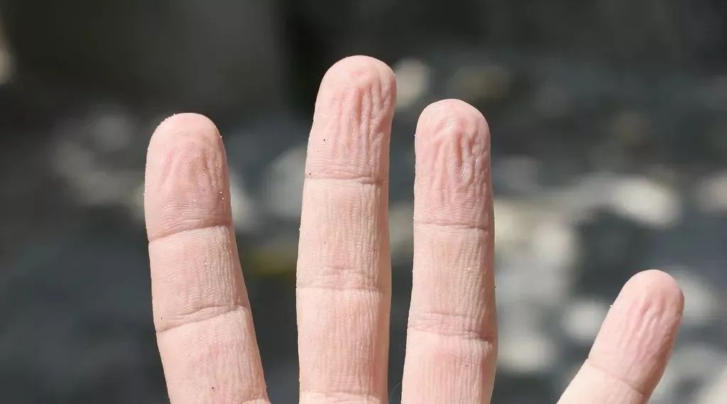 Life question: why do fingers wrinkle?